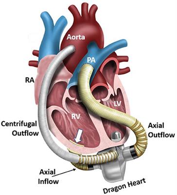 Development of the Centrifugal Blood Pump for a Hybrid Continuous Flow Pediatric Total Artificial Heart: Model, Make, Measure